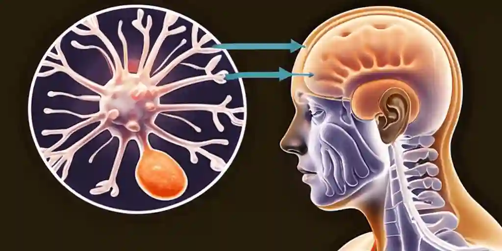 General Paresis: Understanding the Causes, Pathophysiology, Symptoms, Diagnosis, and Treatment 